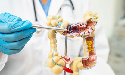 Intestinal Surgery