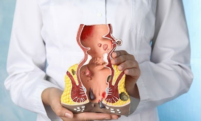 Piles, Fissure & Fistula — Laser